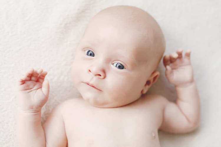 Torticolis congenita en bebe 