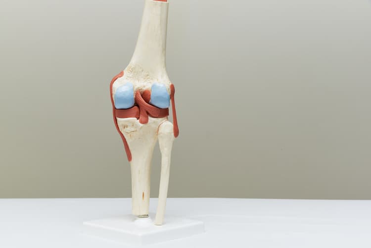 Tratamiento flexo de rodilla