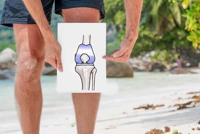 tiempo de recuperación prótesis de rodilla